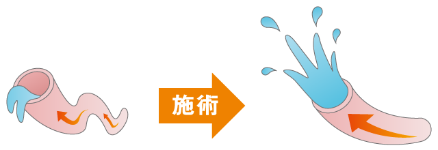 血液循環